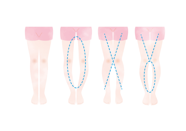 ひざの痛み