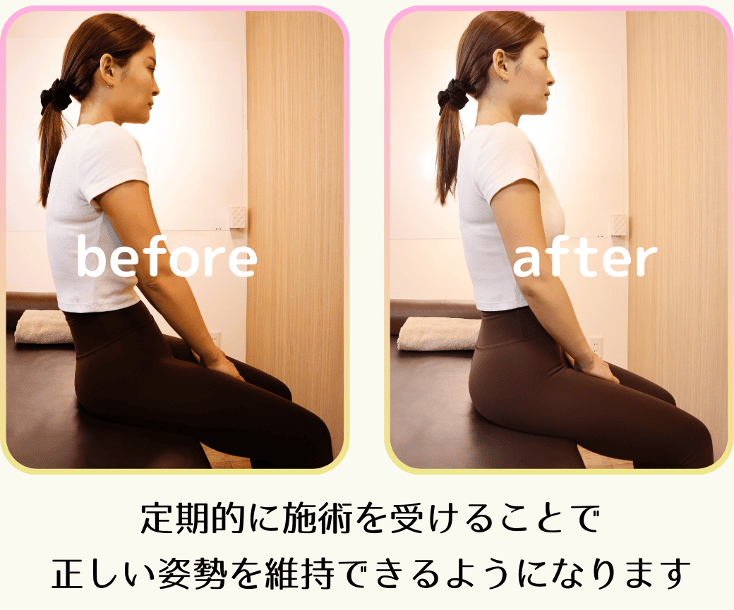 ビフォーアフター