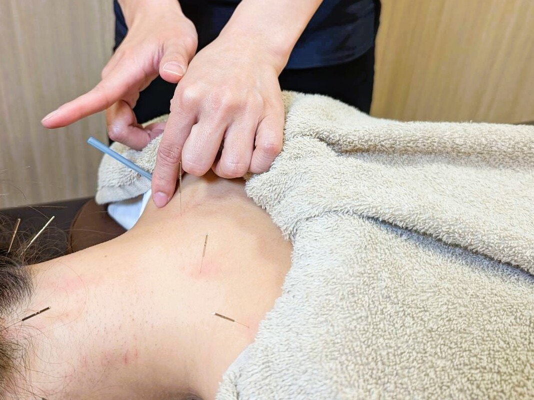 施術の様子