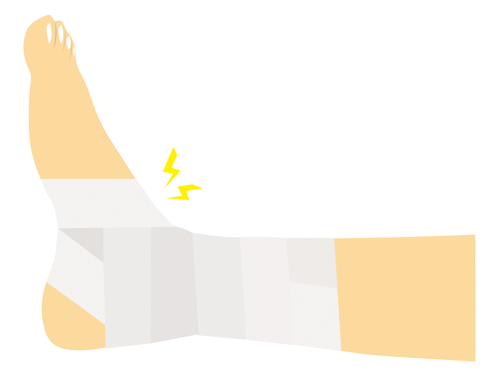 捻挫のイラスト