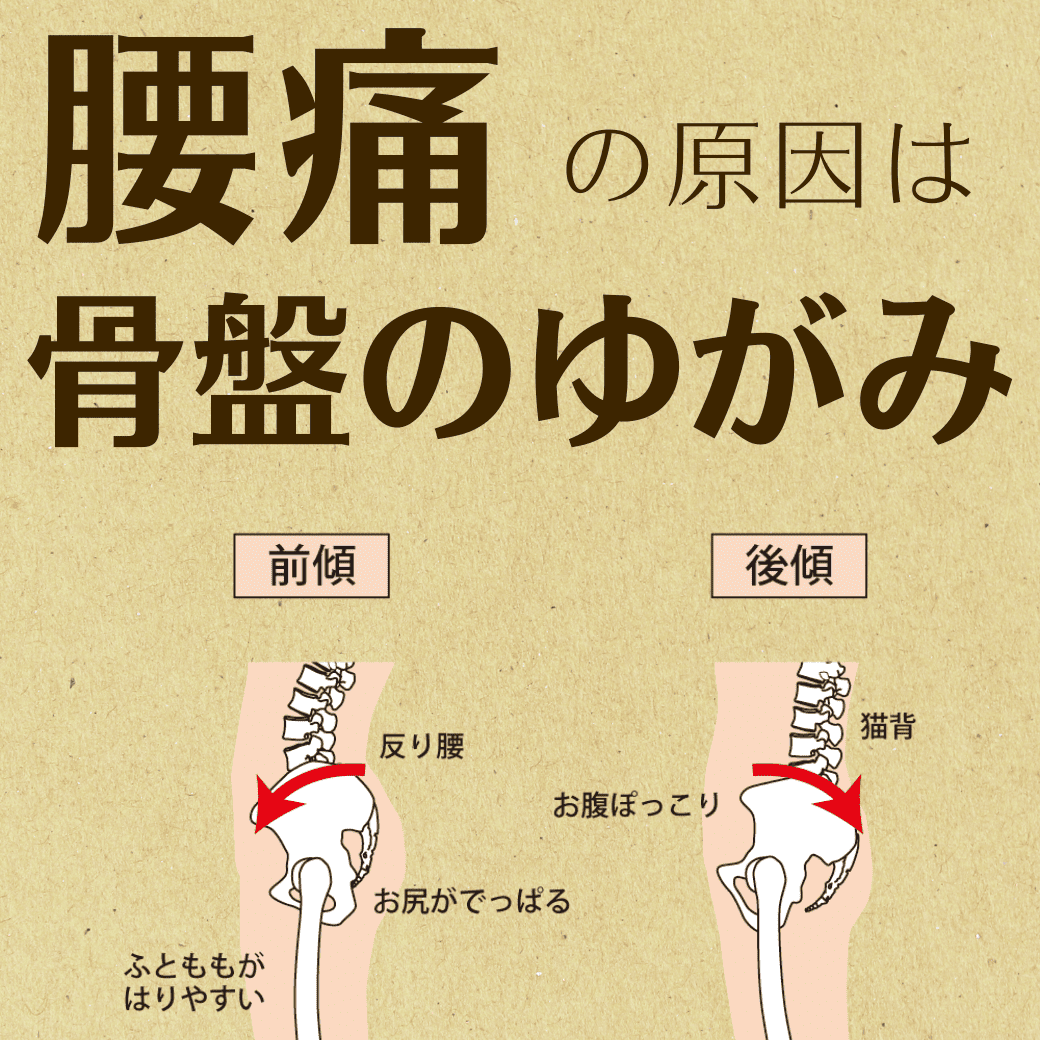 腰痛の原因は骨盤のゆがみ
