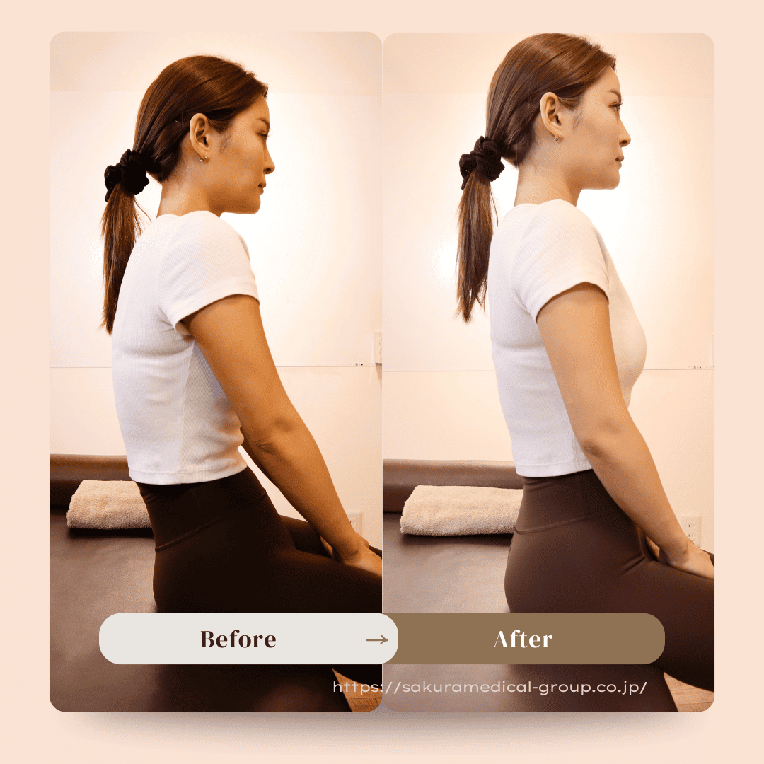 ビフォーアフター