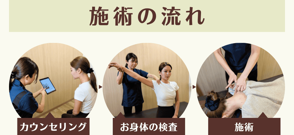 施術の流れ